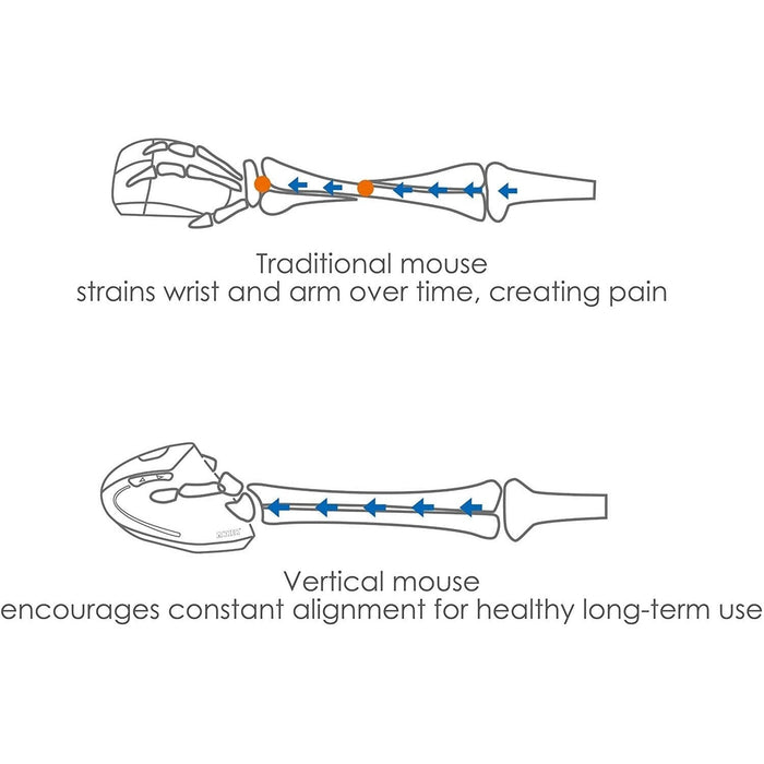 Anker Ergonomic USB 2.4G Wireless Vertical Mouse with 3 Adjustable DPI Levels - Macfixit Australia